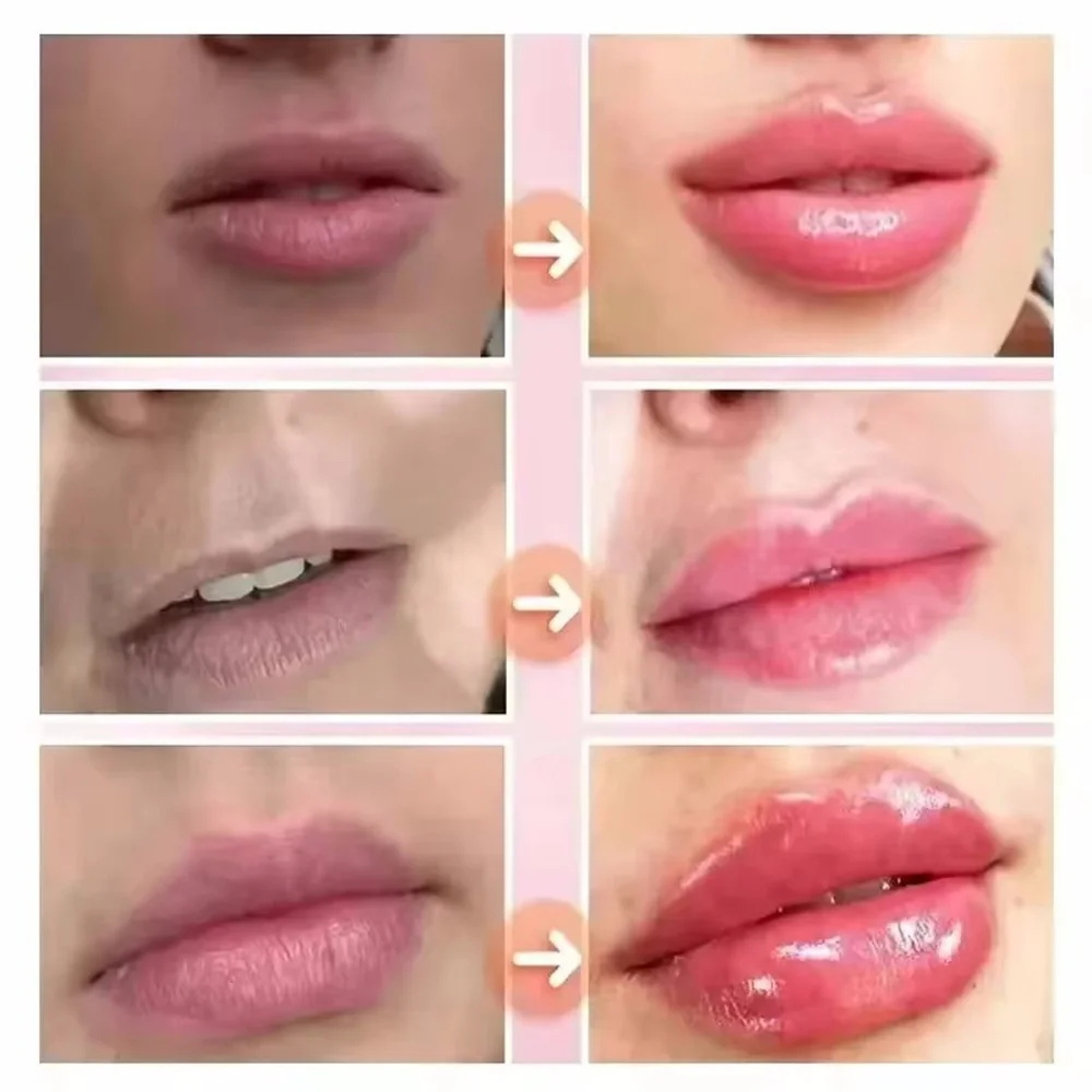 ลิปบาล์มเพิ่มความชุ่มชื้น บำรุ - Lip Gloss Plumping บทวิจารณ์และราคา