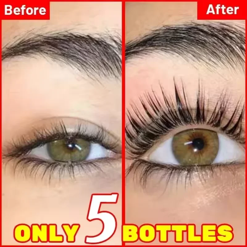 เซรั่มบำรุงขนตา 7 วัน เร่งการเ - Lash Serum Growth บทวิจารณ์และราคา