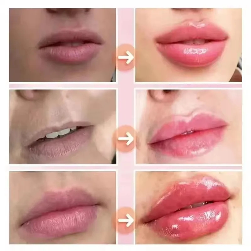น้ำมันบำรุงริมฝีปากแบบทันที ช่ - Lip Gloss Plumping บทวิจารณ์และราคา