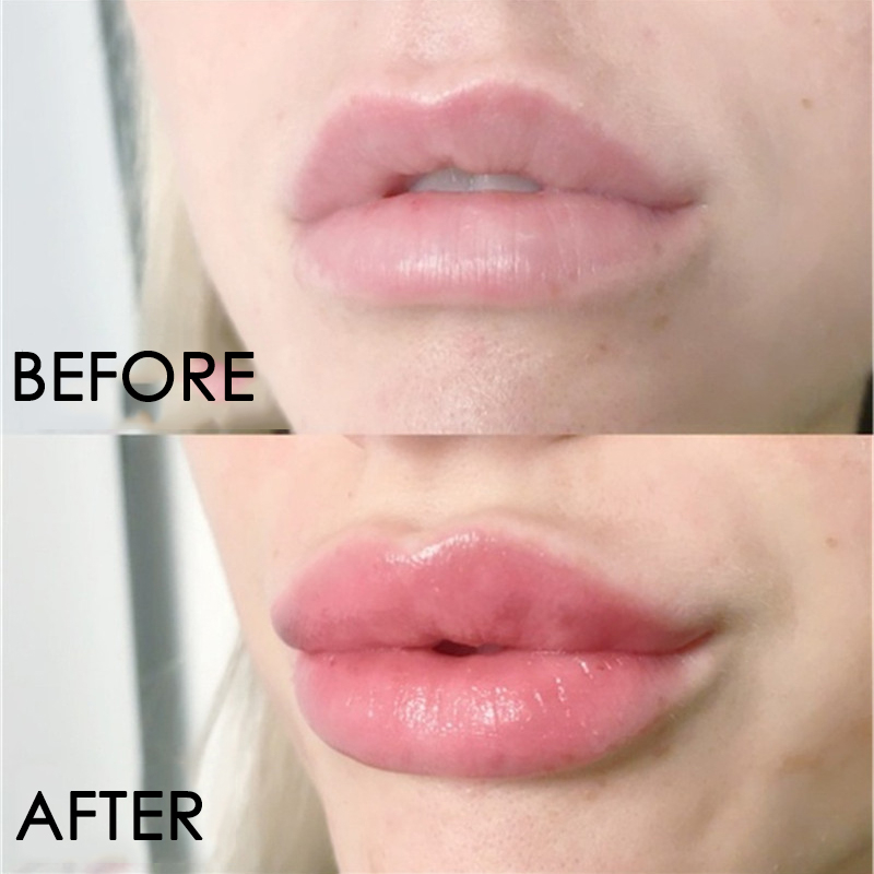 Lip Care Serum Instant Volumis - Lip Gloss Plumping บทวิจารณ์และราคา